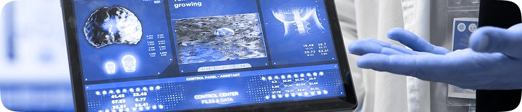 Ongoing optimization